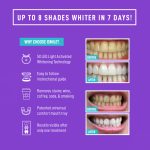 Smile Direct Club LED Teeth Whitening Kit