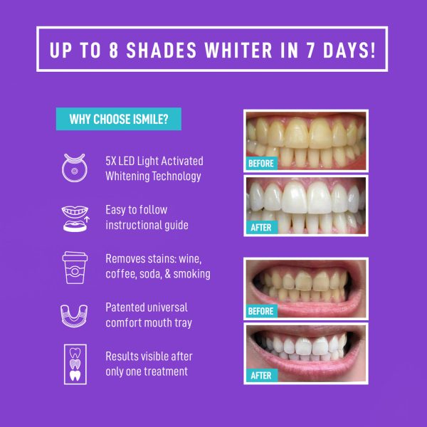 Smile Direct Club LED Teeth Whitening Kit